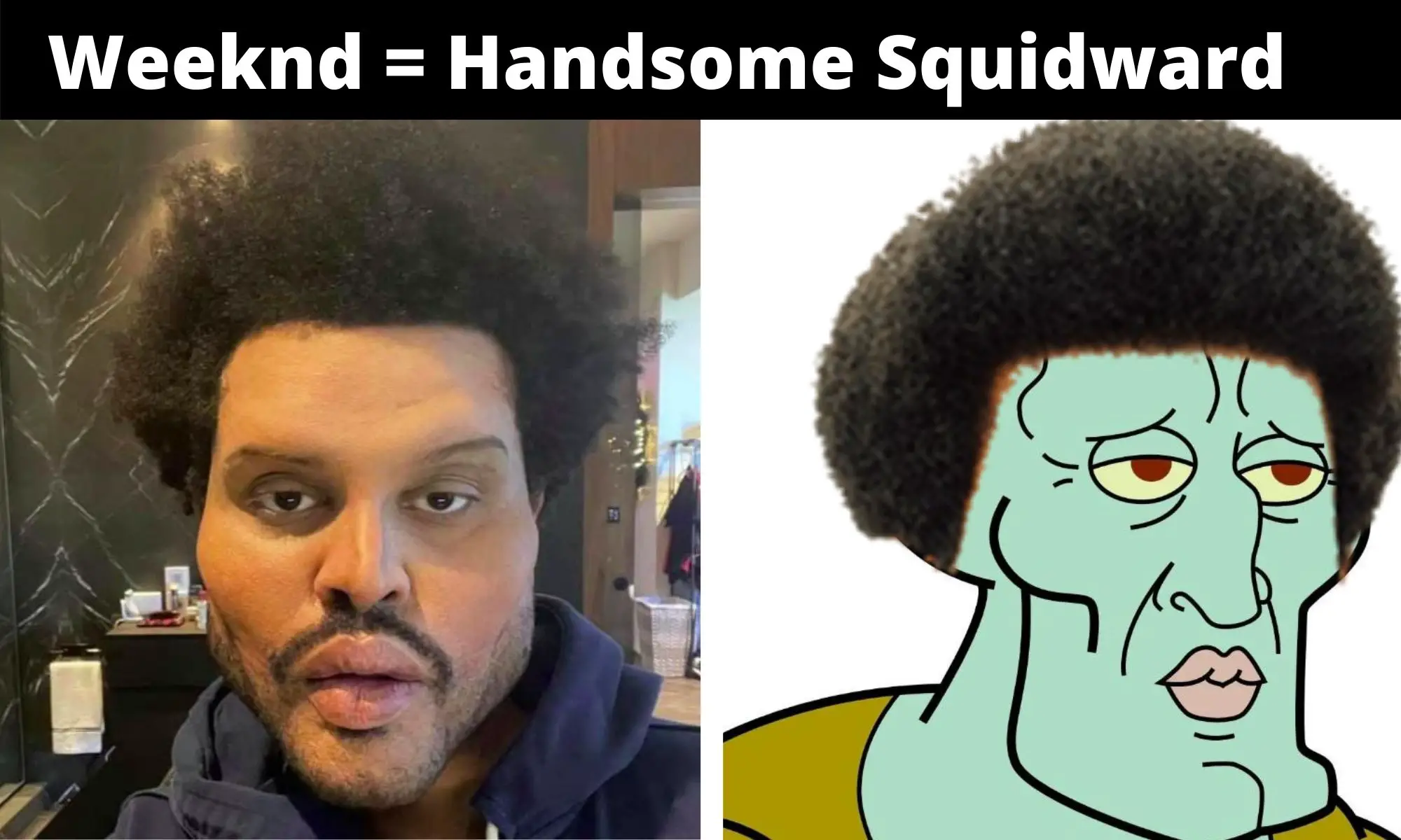 The Weeknd Plastic Surgery Meme On Handsome Squidward