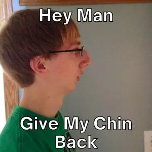 No Chin Meme on Hey Man