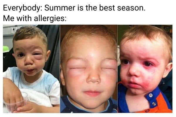 Summer Allergies Meme