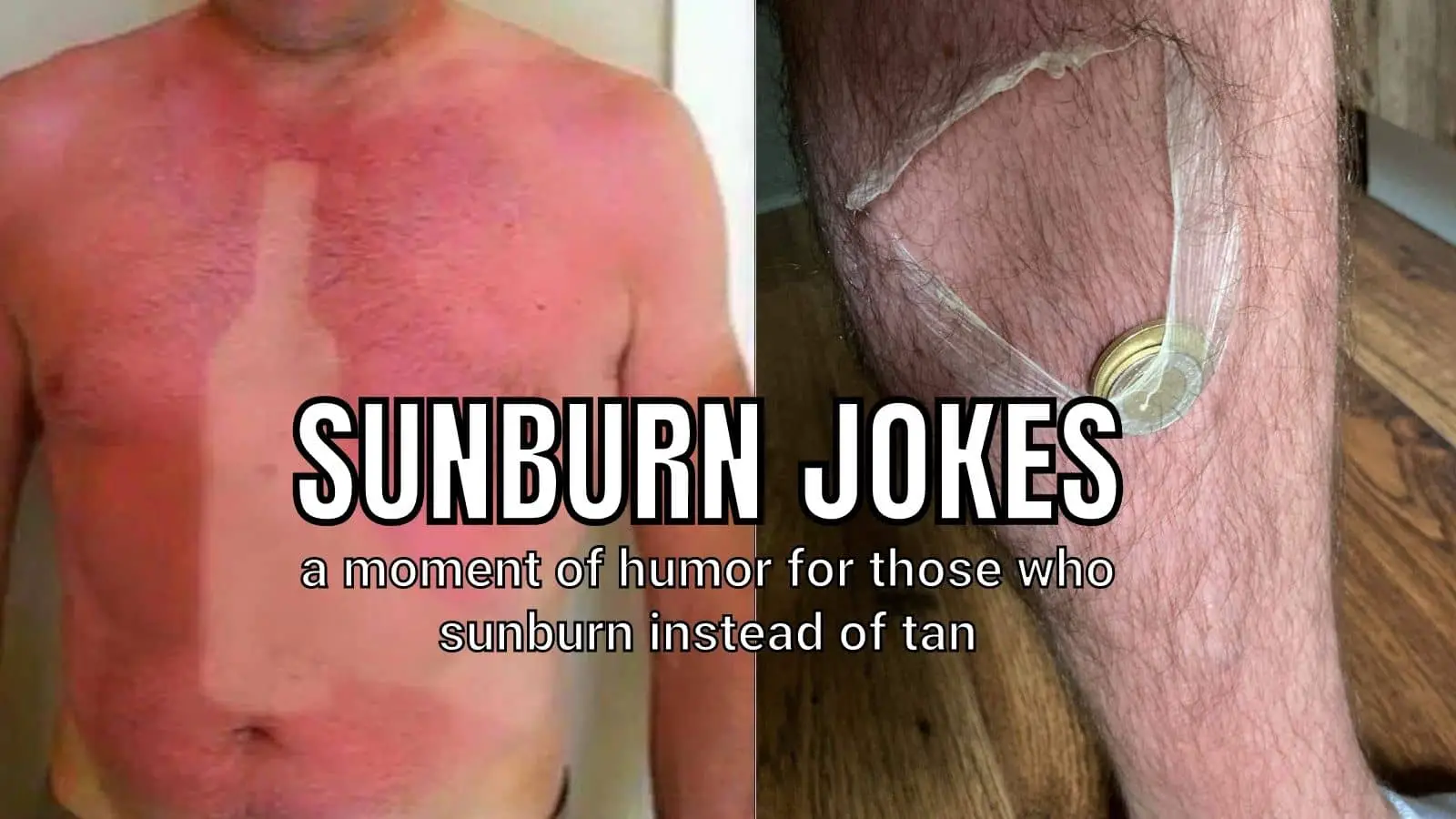 Funny Sunburn Jokes on Tan