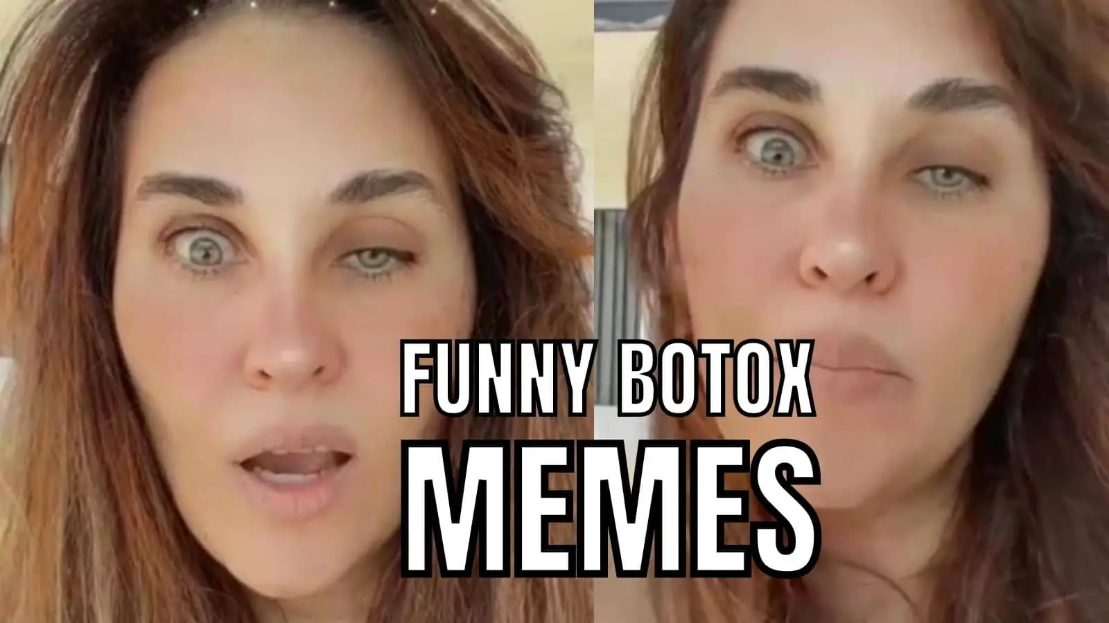 Botox Memes On Side Effect