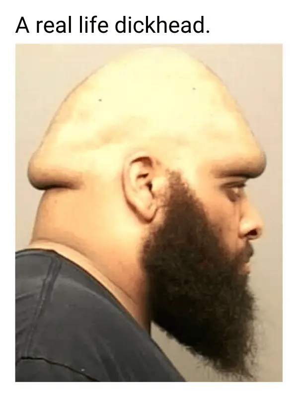 Dickhead Meme on Bald Man