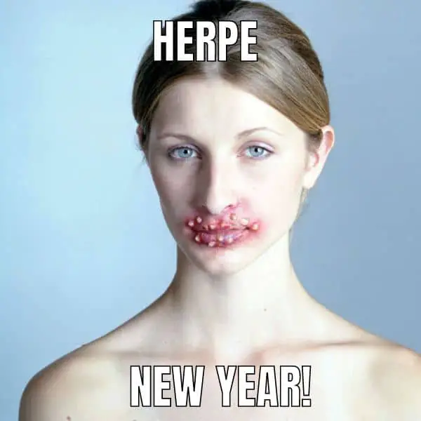 Herpe New Year Meme